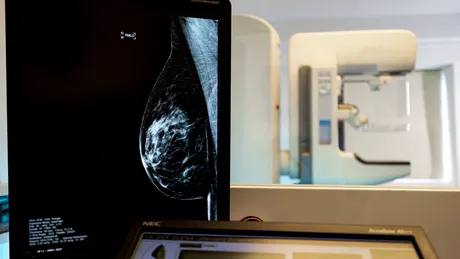 Cum poate fi diagnosticat din timp cancerul de sân