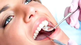 10 Idei Greșite Despre Fațetele Dentare cu Dr. Catrinel Banu