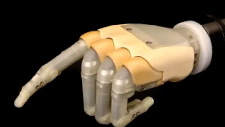 Mana bionica, folosita in premiera intr-o clinica din Targu Mures