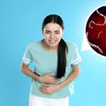 Un parazit intestinal care provoacă diaree severă pune autoritățile în alertă. Se poate ascunde pe fructele și verdețurile consumate crude