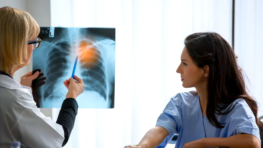 4 lucruri pe care să le faci chiar de azi pentru a-ți reduce riscul de cancer pulmonar