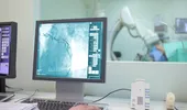 (P) Când ajungi la coronarografie: semnele care arată că nu mai este suficient doar un control de rutină