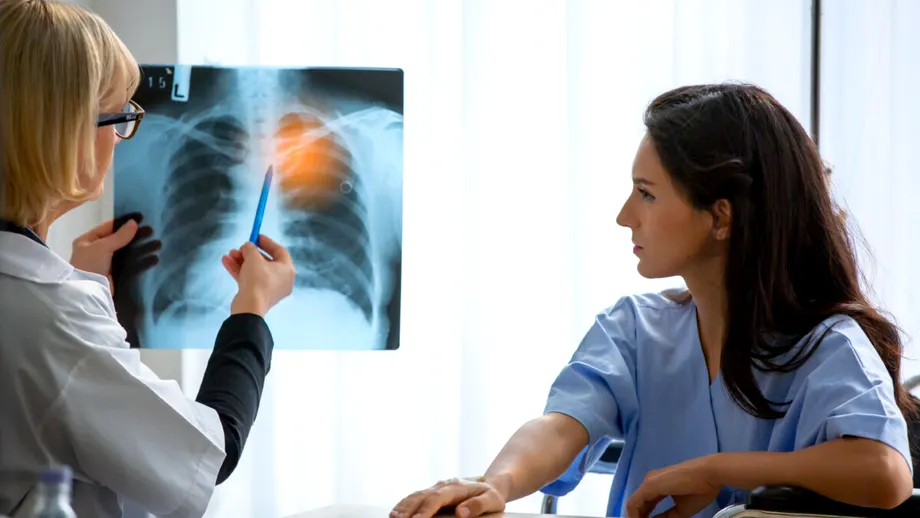 4 lucruri pe care să le faci chiar de azi pentru a-ți reduce riscul de cancer pulmonar