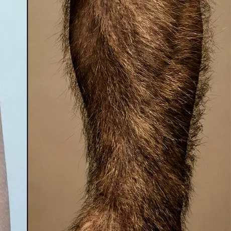 Ce este „pielea de găină”, de fapt: O încercare eșuată a corpului tău de a părea fioros