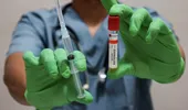 Vaccinul împotriva zonei zoster ar putea reduce riscul de infarct și AVC. Ce arată un nou studiu