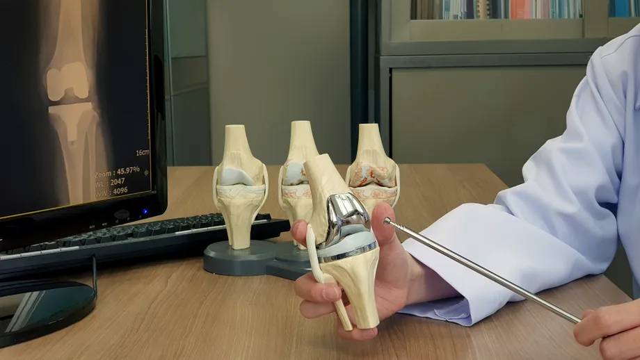 Artroplastia totală de genunchi: „Este indicată în formele avansate de gonartroză”