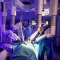 Tratament chirurgical pentru cancerul de colon