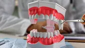 Sănătatea gurii este esențială pentru sănătatea întregului organism. 11 moduri în care afecțiunile dentare îți influențează starea de bine