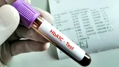 De ce poate crește hemoglobina glicată (HbA1c)? Glicemia ridicată nu este singura explicație