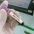 Deficiența de fier poate influența rezultatele testului pentru diabet. Ce ar trebui să facă pacienții