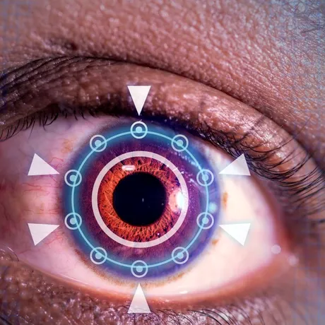 Cum te pregătești pentru chirurgia refractivă laser, operația care te scapă de ochelari