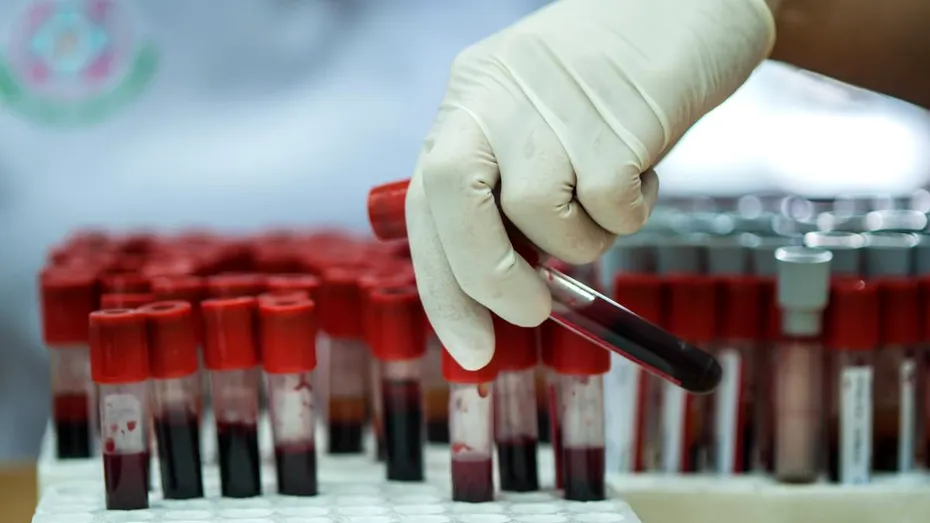De ce nu este recomandat să îți faci analizele imediat după vacanță. Explicațiile unui medic de laborator