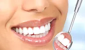 Secretele zâmbetului perfect: faţetele şi coroanele dentare VIDEO by CSID