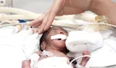 În 2 maternităţi din ţară, părinţii îşi vor putea îngriji bebeluşii prematuri