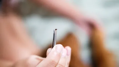 Pericolul căpușelor în sezonul cald. Ce faci dacă ai fost mușcat?