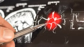 Ce se întâmplă când te repeți sau pui aceeași întrebare de mai multe ori. Problema de memorie la care te aștepți cel mai puțin