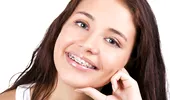 Cum obţii un zâmbet frumos şi sănătos? De ce nu este scump un aparat dentar?