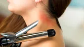 5 soluții care te vor ajuta să tratezi mai ușor arsurile cauzate de ondulator sau placă de păr