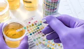 Ceaiul care ajută la ameliorarea infecțiilor urinare. Remediul vechi folosit de bunici pentru sănătatea rinichilor