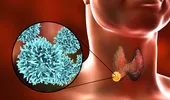 Cancerul de tiroidă: cum se tratează explică dr. Corina Neamțu