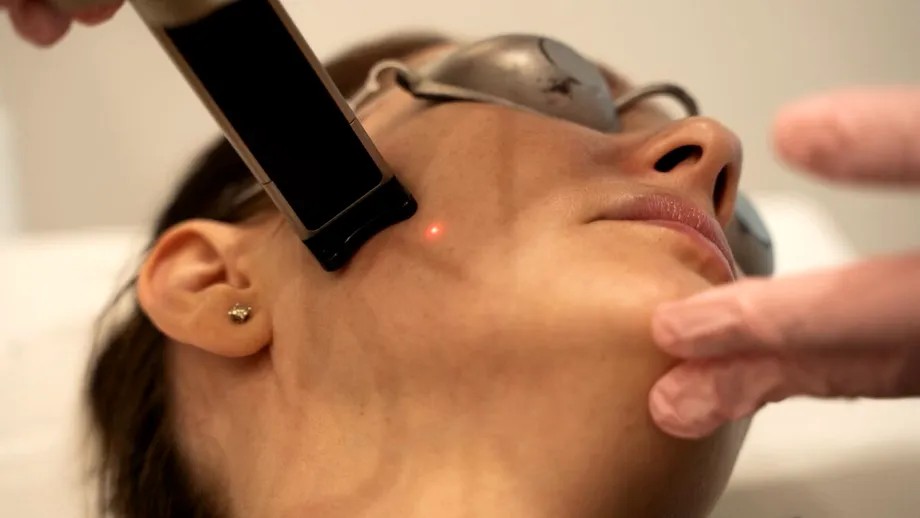 Lifting optim, fără chirurgie, procedura cu recuperare rapidă pe care tot mai multe femei o aleg