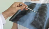 Această femeie s-a ales cu o boală nemiloasă, după ce a stat în casă în timpul pandemiei! Pericolul ascuns la care s-a expus în propria locuință