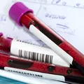 Ce analize de sânge pot arăta daca diabetul a afectat deja rinichii
