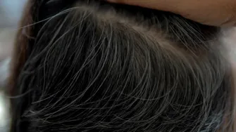 Mit sau realitate: crește mai mult păr dacă smulgi un fir alb? Ce spun specialiștii