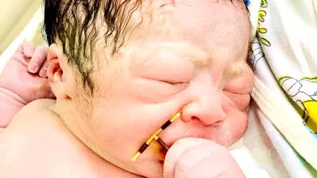 Ironia sorţii. Un bebeluş s-a născut cu steriletul mamei în mână. Fotografiile virale