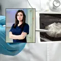 De ce ecografia nu este suficientă în endometrioza profundă și de ce RMN-ul schimbă planificarea intervenției