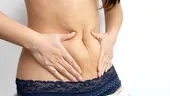 Ai impresia că te-ai îngrășat? Testul simplu care arată dacă este balonare sau grăsime pe abdomen