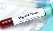 Testul TSH: nivelul hormonului de stimulare a tiroidei