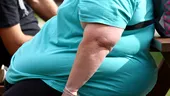 Diagnosticul de obezitate înainte de 30 de ani crește riscul de moarte prematură cu 70%