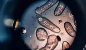 Cum să faci o curățare eficientă a paraziților intestinali