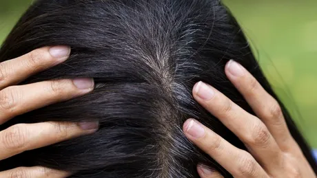 Cum să previi sau să întârzii albirea părului. De ce albește părul