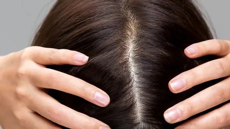 5 motive pentru care ai părul deteriorat