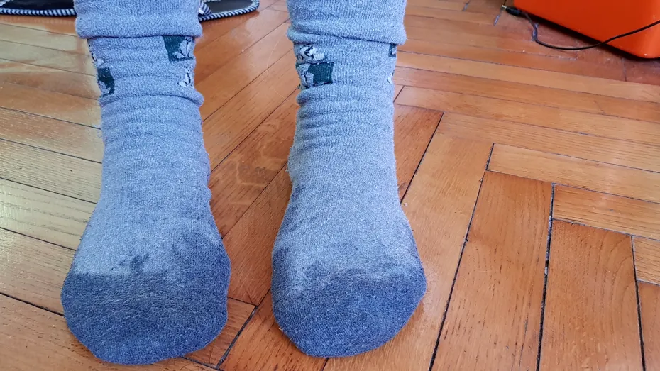 3 mituri despre leacurile băbești. De ce NU E BINE să porți șosete cu oțet sau să pui albuș pe o arsură