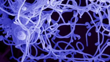 Virusul Ebola a persistat în sperma unui bărbat mai mult de 500 de zile