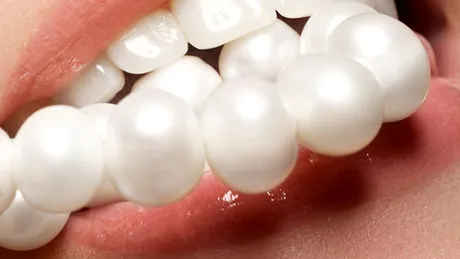 Faţetele dentare: prefabricate vs la comandă