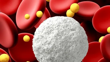 Trombocitoza: simptome, tratament