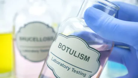 Botulismul: simptome, tratament