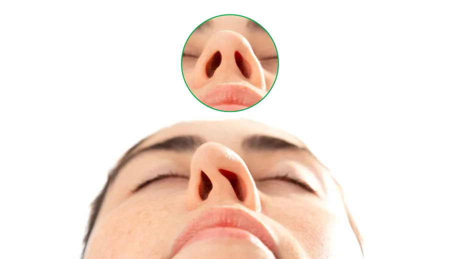 Rinoseptoplastia, operația 2 în 1: corectează aspectul nasului și deviația de sept