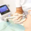 (P) Albirea dentară cu laser Dioda: alternativa în cabinet la metodele clasice cu gutiere