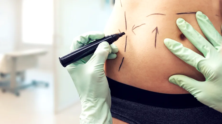 Un medic estetician din Constanța este anchetat pentru că a mutilat mai multe paciente. Tinerele au rămas cu sechele pe viață