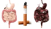 Fumatul - cum îți distruge stomacul și ficatul. Fiecare țigară îți răpește 11 minute din viață