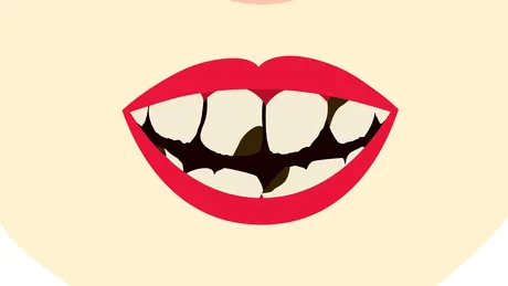 Cel mic şi-a spart un dinte? Medicul stomatolog explică ce e de făcut imediat după accident