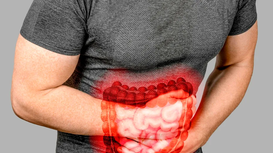 Ce poate ascunde o durere acută de abdomen?