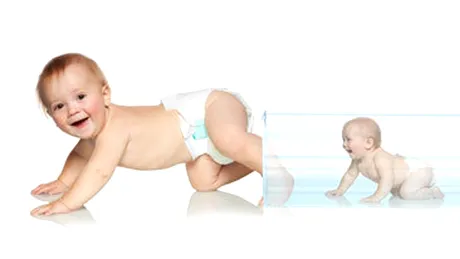 Fecundarea in vitro poate creşte riscul de retard mintal