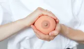 Culoarea mameloanelor – semnul care apare în cancerul de sân