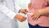 Studiu: două treimi dintre femeile din România consideră obezitatea atât o boală cronică, cât și o problemă de stil de viață